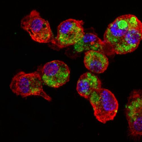 La entrada de la nano vacuna a las células del sistema inmunológico lleva a que éste sea activado contra las células cancerígenas. –(Foto: Ronit Saci-Fainaro)- La entrada de la nano vacuna a las células del sistema inmunológico lleva a que éste sea activado contra las células cancerígenas. –(Foto: Ronit Saci-Fainaro)-