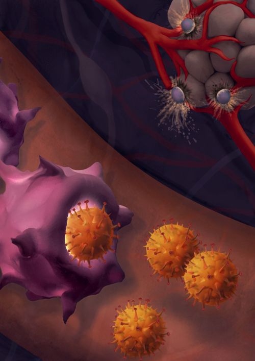 La nano vacuna incrementa la sensibilidad del cáncer de piel a la inmunoterapia y lleva a la muerte de las células cancerígenas. (Ilustración: Maayan Harel) La nano vacuna incrementa la sensibilidad del cáncer de piel a la inmunoterapia y lleva a la muerte de las células cancerígenas. (Ilustración: Maayan Harel)