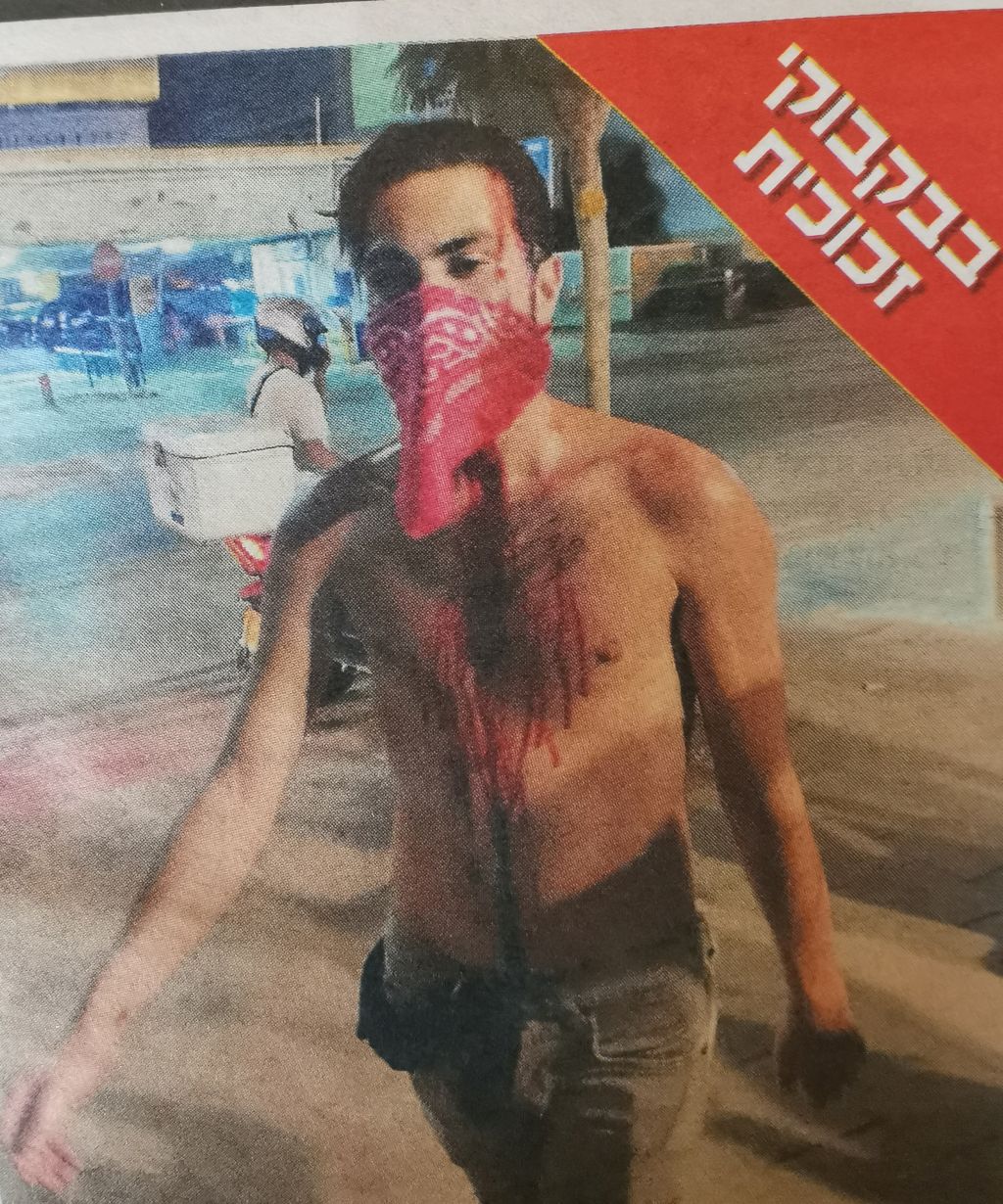 Así quedó uno de los manifestantes atacados-Foto: Be Netzer, Galei Tzahal