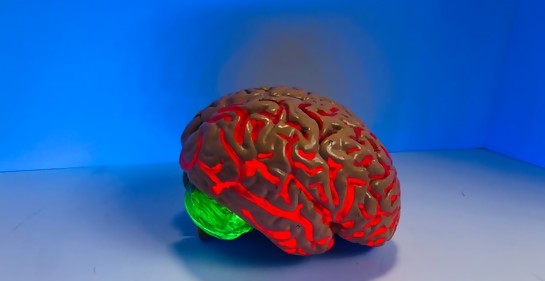 Científicos del Technion  desarrollaron una molécula artificial que podría desacelerar el desarrollo del Alzheimer