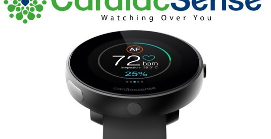 Un reloj inteligente que controla a pacientes cardíacos recibe aprobación de la FDA